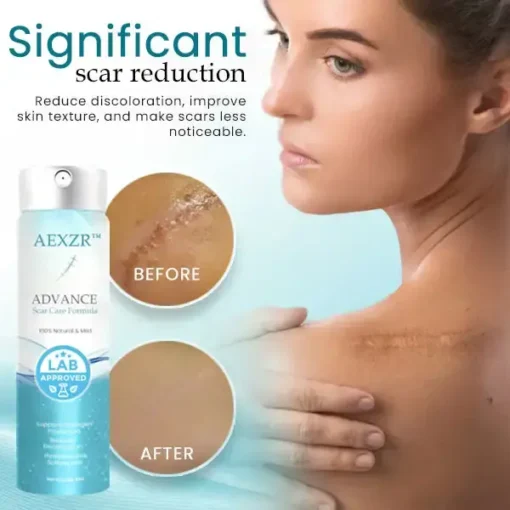 AEXZR™ Advance Scar Care Formula - Image 4