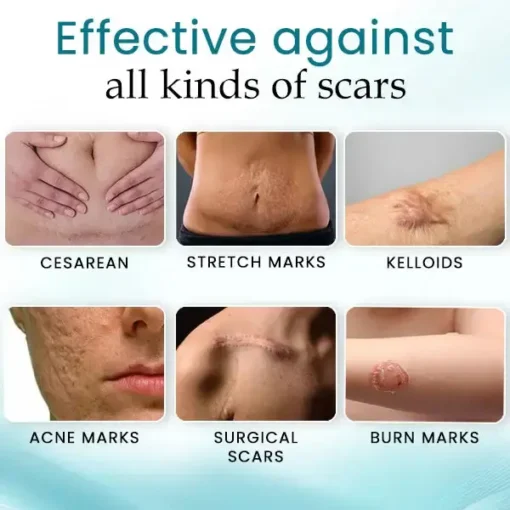 AEXZR™ Advance Scar Care Formula - Image 5