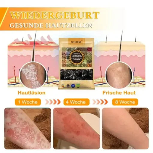 Aeehfeng™ 30 Kräuter Lymphdrainage & Gewichtsrduktion Fußbadperlen - Image 10