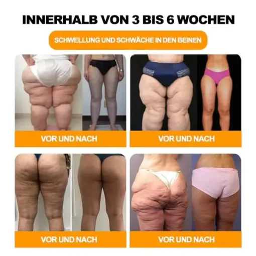 Aeehfeng™ 30 Kräuter Lymphdrainage & Gewichtsrduktion Fußbadperlen - Image 3