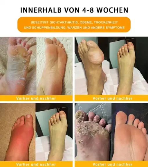 Aeehfeng™ 30 Kräuter Lymphdrainage & Gewichtsrduktion Fußbadperlen - Image 5