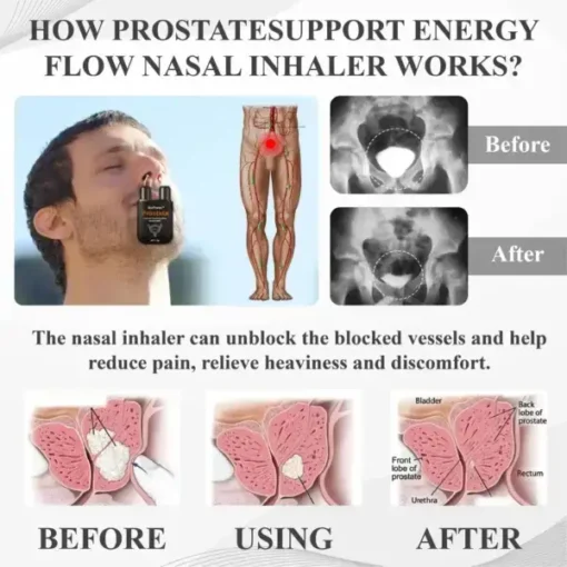 BeeProsta™ ProstateSupport Energy Flow Nasal Inhaler - Image 6