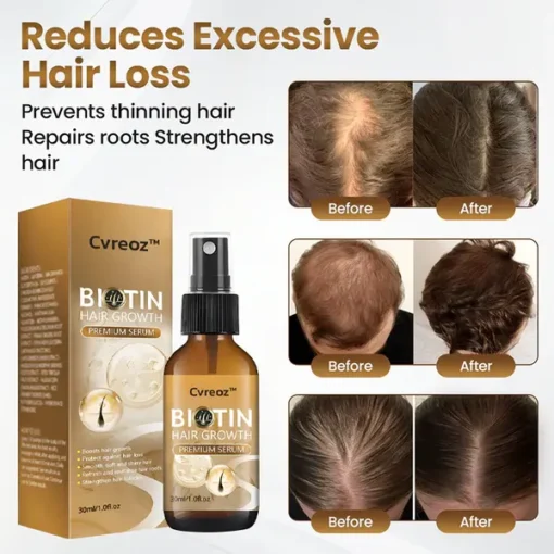 CVREOZ™ Biotin Hair Growth Premium Serum – Proven and Tested by Experts! - Image 8