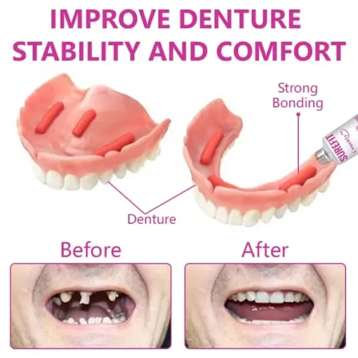 Ceoerty™ SureFit Thermal Denture Adhesive - Image 3