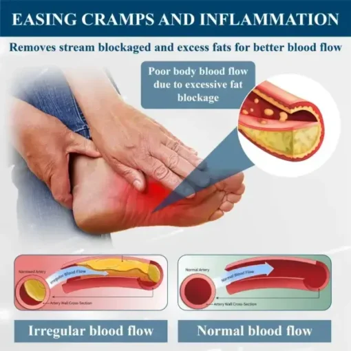 CircuSupport™ Magnetic EdemaCare Insoles - Image 9