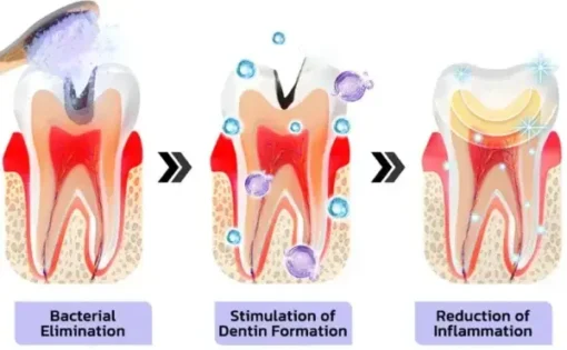 Coolord™ TeethRestoration Mineral Powder - Image 3