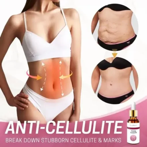 CurvyBeauty Belly Slimming Massage Oil - Image 5