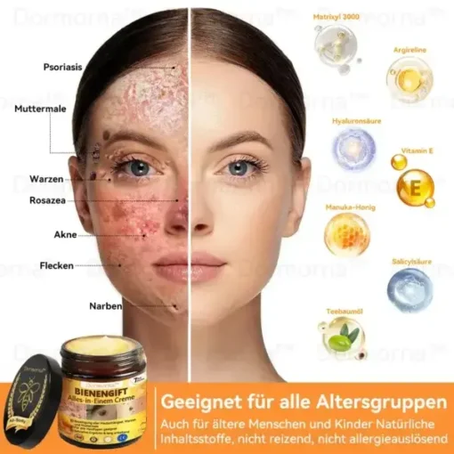 Dormorna™ Bienengift Alles-in-Einem Creme - Image 10