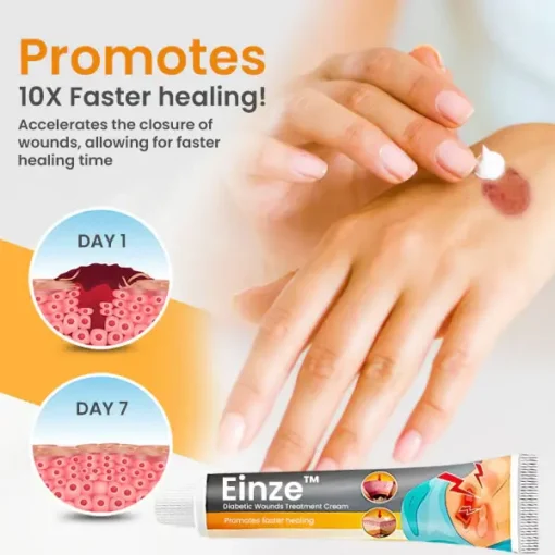 Einze™ Diabetic Wounds Treatment Cream - Image 3