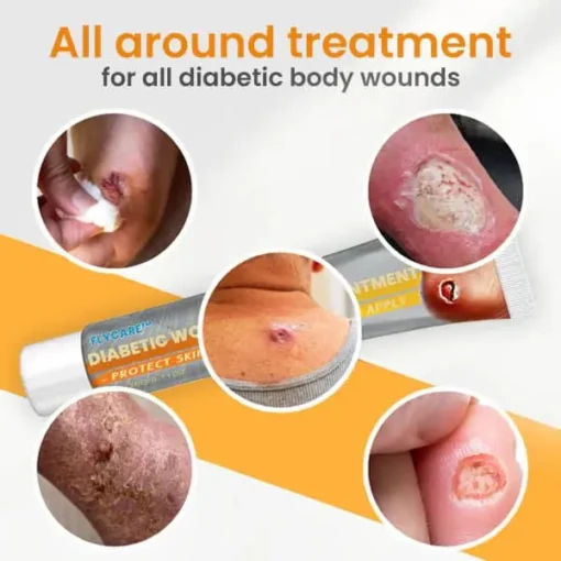 FLYCARE™ Diabetic Wounds Healing Ointment - Image 3