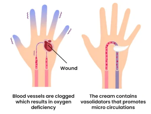 FLYCARE™ Diabetic Wounds Healing Ointment - Image 8