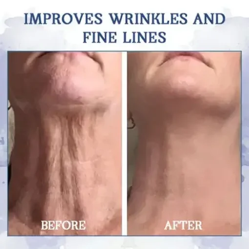 Fivfivgo™ Advanced Firming & Wrinkle-Reducing Cream - Image 5