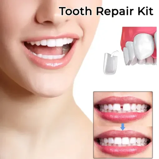 Fivfivgo™ Dental Temporary Crown Veneers - Image 4