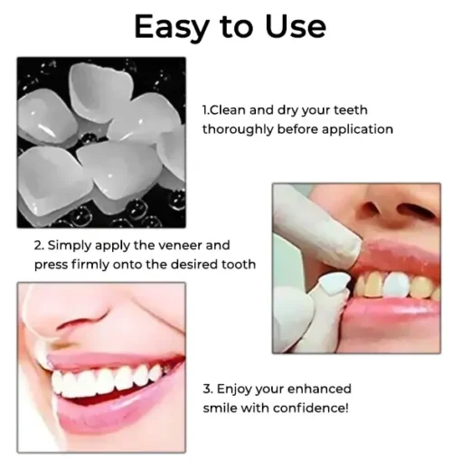 Fivfivgo™ Dental Temporary Crown Veneers - Image 6