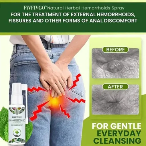 Fivfivgo™ Herbal Hemorrhoid Spray - Image 5