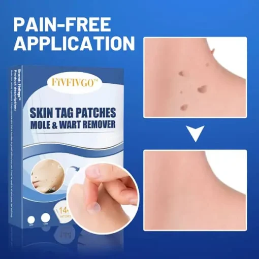 Fivfivgo™ Moles & Warts Removing Skin Tag Patch - Image 5