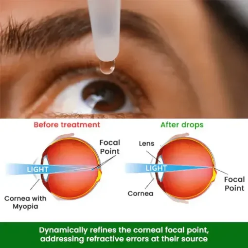 Fivfivgo™ Myopia Cure Drops - Image 4