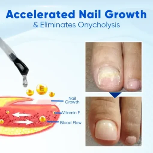 Fivfivgo™ NailNourish Growth & Repair Serum - Image 6