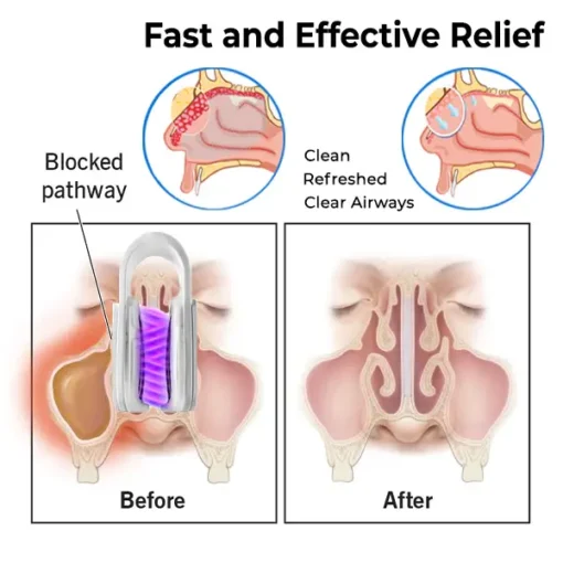 Fivfivgo™ Nasal Mucus Cleaning Device - Image 3