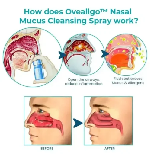 Fivfivgo™ Nasal Mucus Cleansing Spray - Image 3