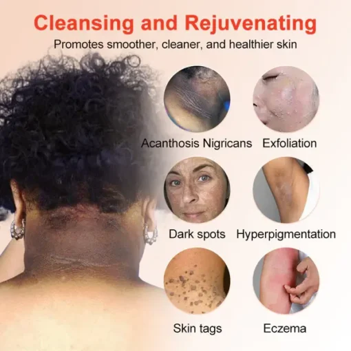 Fivfivgo™ Purifying Exfoliating Gel for Acanthosis Nigricans, Exfoliation - Image 6