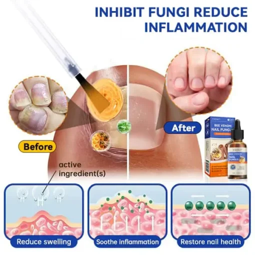 Furzero™ Bee Venom Nail Fungus Treatment Solution: Restore nail health - Image 10