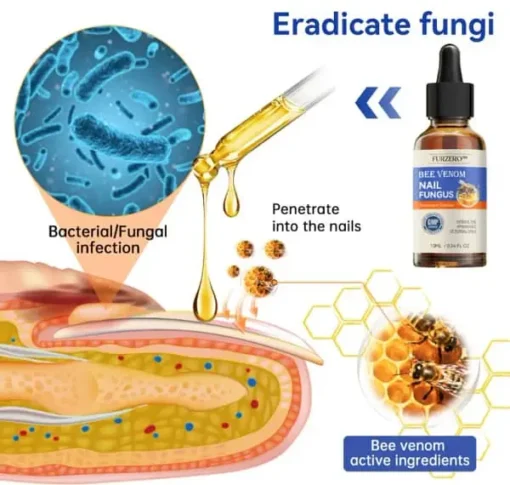 Furzero™ Bee Venom Nail Fungus Treatment Solution: Restore nail health - Image 9