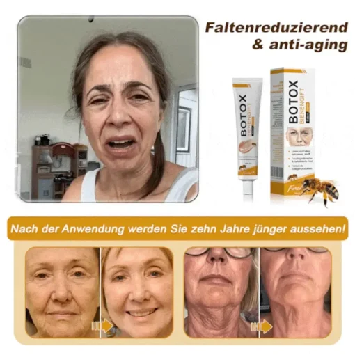 Furzero™ Botox Bienenvenom Faltenentfernungscreme - Image 9