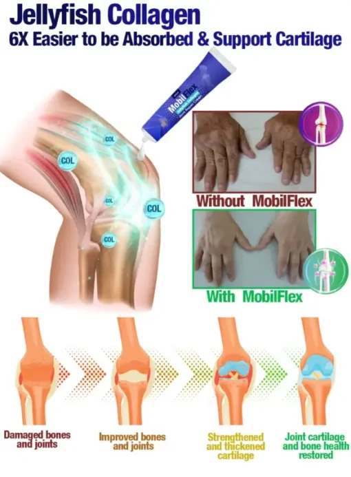 GFOUK™ MobilFlex Jellyfish Collagen Joint Repair Cream - Image 2