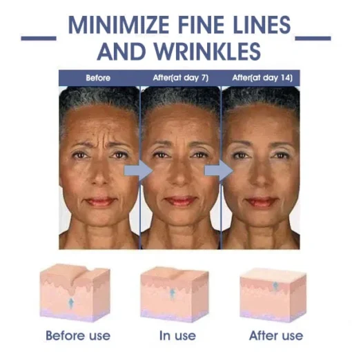 JEREMYTIS™ Skin Lifting WrinkleRemovalCream - Image 9