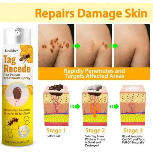 LOVILDS™ TagRecede Bee Poison Treatment Spray - Image 2