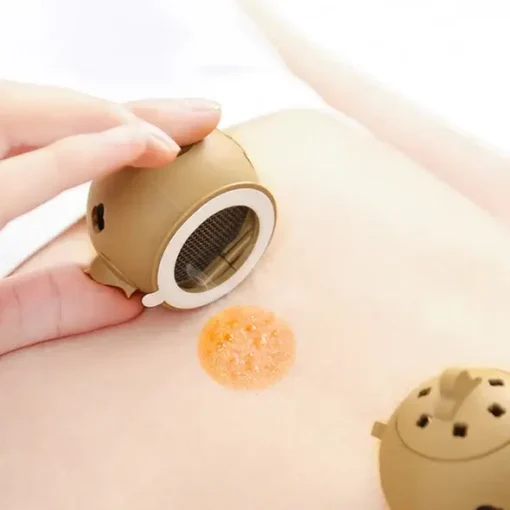 Moxa Cupping Acupuncture Detox Set - Image 5