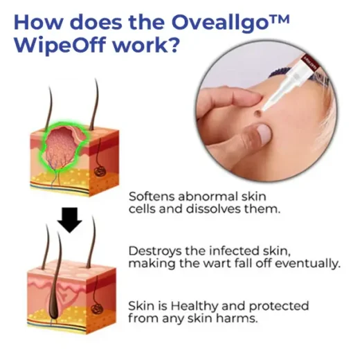 Oveallgo™ WipeOff Tags & Moles Remover - Image 8