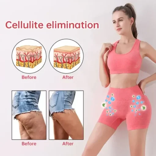 Paiduis™ Micro-Vibration Massage Module Ice Silk Ion Fiber Repair Shaping Shorts - Image 5