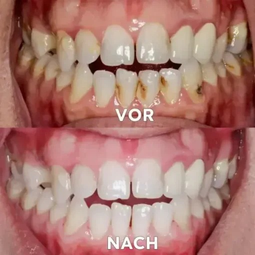 Seurico™ Zahnfleischreparatur & Mundgesundheits-Pulver - Image 3