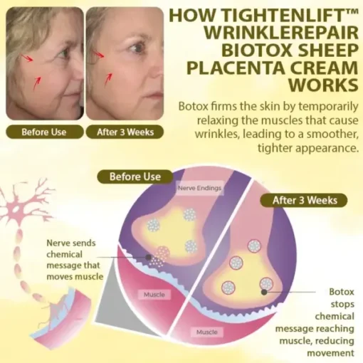 TightenLift™ WrinkleRepair BioTox Sheep Placenta Cream - Image 10