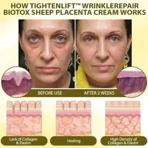 TightenLift™ WrinkleRepair BioTox Sheep Placenta Cream - Image 6