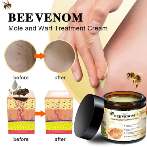 Turonu™ Bee Venom Mole and Wart Treatment Cream - Image 2