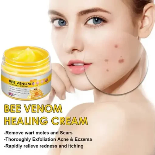 Velisse ™ Bee Venom Skin Cream, for Remove Warts, Acne and Scars-Treats Multiple Skin Conditions - Image 10