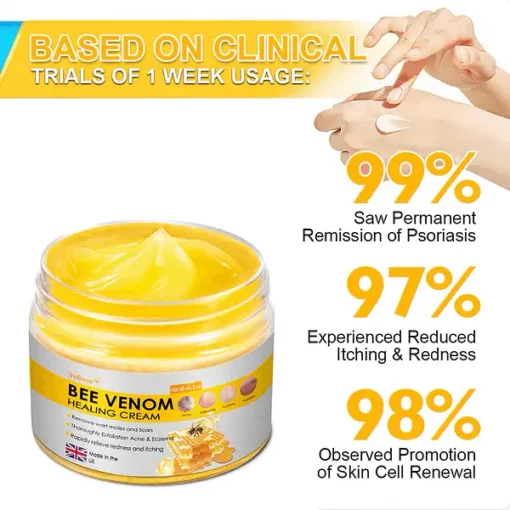 Velisse ™ Bee Venom Skin Cream, for Remove Warts, Acne and Scars-Treats Multiple Skin Conditions - Image 15