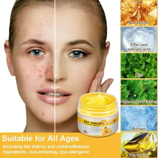 Velisse ™ Bee Venom Skin Cream, for Remove Warts, Acne and Scars-Treats Multiple Skin Conditions - Image 2