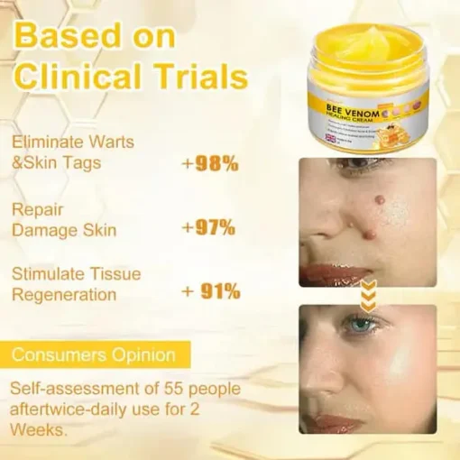 Velisse ™ Bee Venom Skin Cream, for Remove Warts, Acne and Scars-Treats Multiple Skin Conditions - Image 9