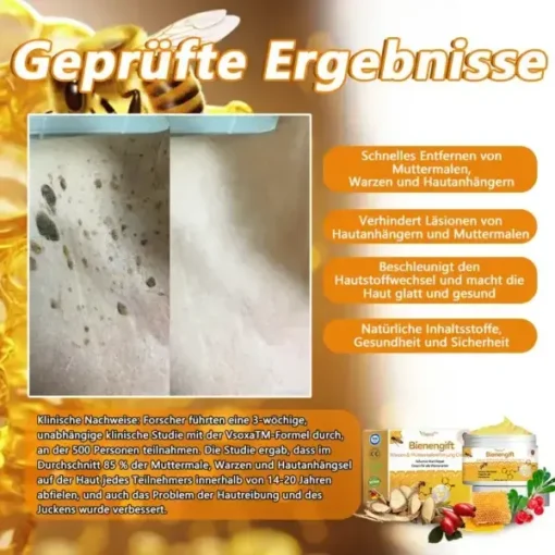 Vsoxa™ Bienengift Waren & Muttermalenfernung Creme - Image 3