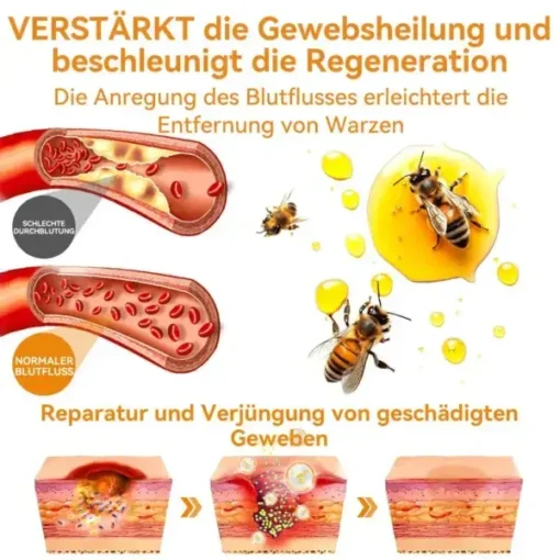 Vsoxa™ Bienengift Waren & Muttermalenfernung Creme - Image 9