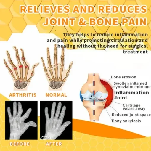 Winter Sale AQA™ Bee Essence Joint Therapy Pain Relief Gel - Image 3