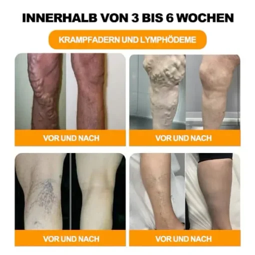 Winter Sale Aeehfeng™ 30 Kräuter Lymphdrainage & Gewichtsrduktion Fußbadperlen - Image 4