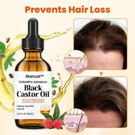 Winter Sale Biancat™ FolliclePro Jamaican Black Castor Oil - Image 3