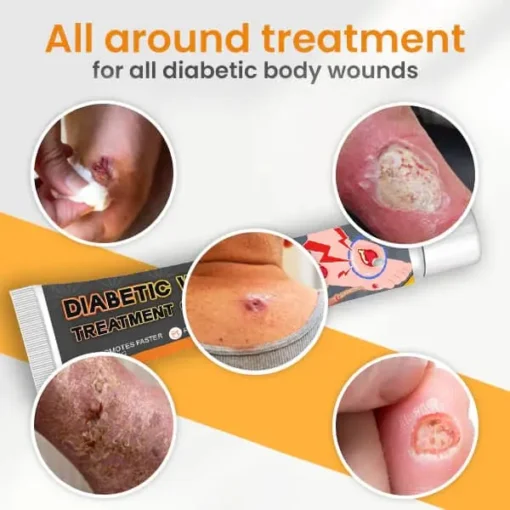 FITINDIA™ Diabetic Wounds Treatment Cream - Image 4