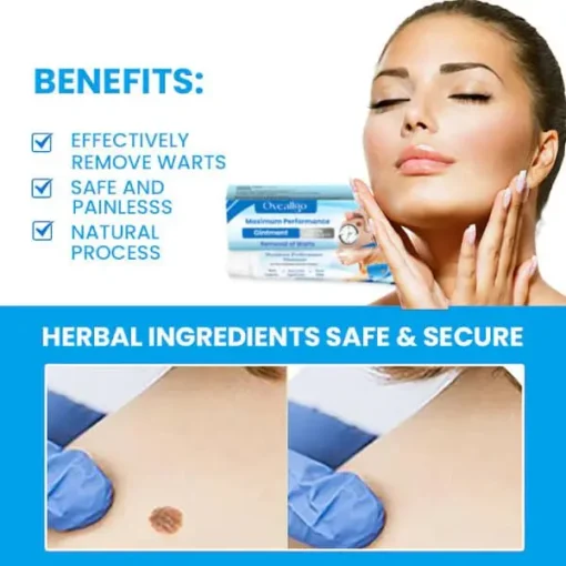 Fivfivgo™ Maximum Performance Ointment for the Immediate removal of Warts - Image 3