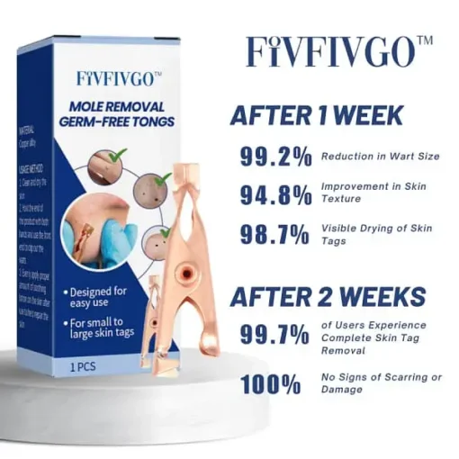 Winter Sale Fivfivgo™ Mole Removal Germ-Free Tongs - Image 3